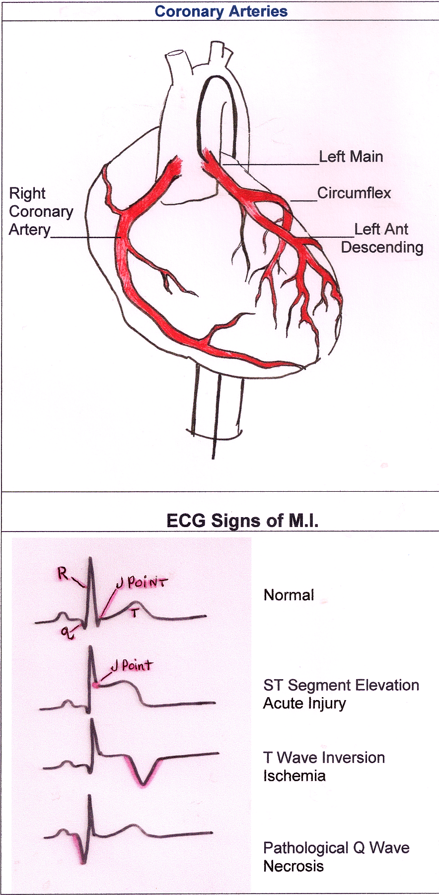 Illustration Ecg Guru Instructor Resources